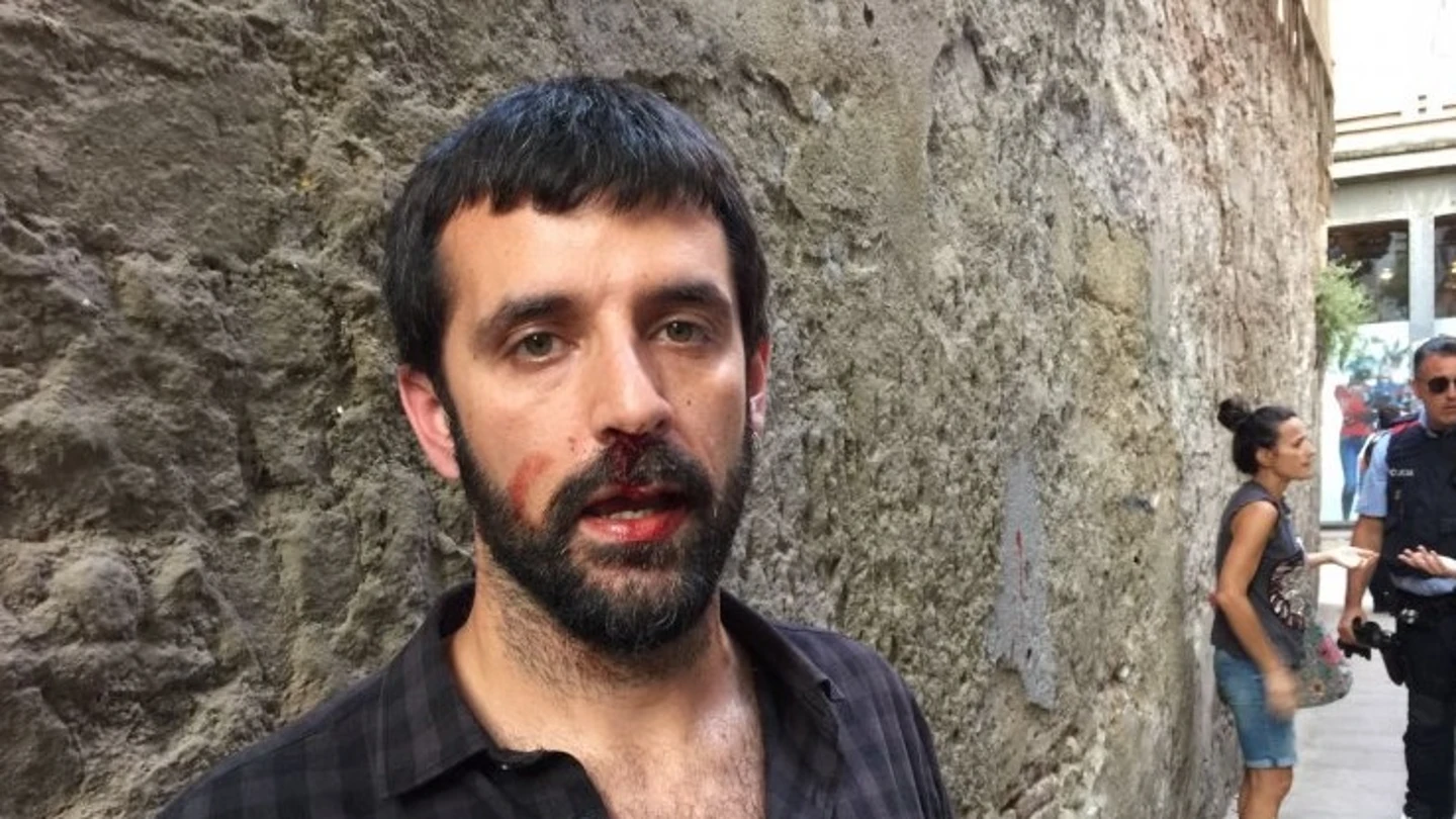 El fotoperiodista Jordi Borràs denuncia que un policía le agredió El fotoperiodista Jordi Borràs denuncia que un policía le agredió