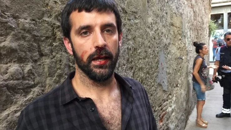 El fotoperiodista Jordi Borràs denuncia que un policía le agredió