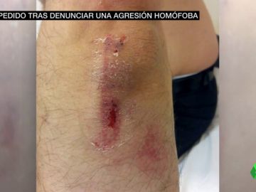 Karim, agredido por ser homosexual y marroquí: "Gracias a mi brazo estoy aquí, si no hubiera sido una muerte segura" Karim, agredido por ser homosexual y marroquí: "Gracias a mi brazo estoy aquí, si no hubiera sido una muerte segura"