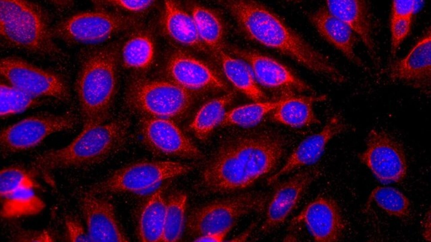 Las reacciones al&eacute;rgicas pueden proteger contra el c&aacute;ncer de piel