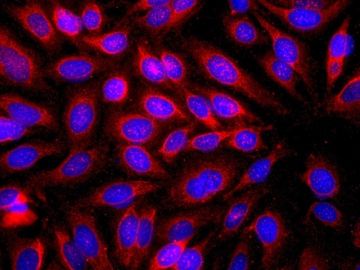 Las reacciones alérgicas pueden proteger contra el cáncer de piel Las reacciones alérgicas pueden proteger contra el cáncer de piel
