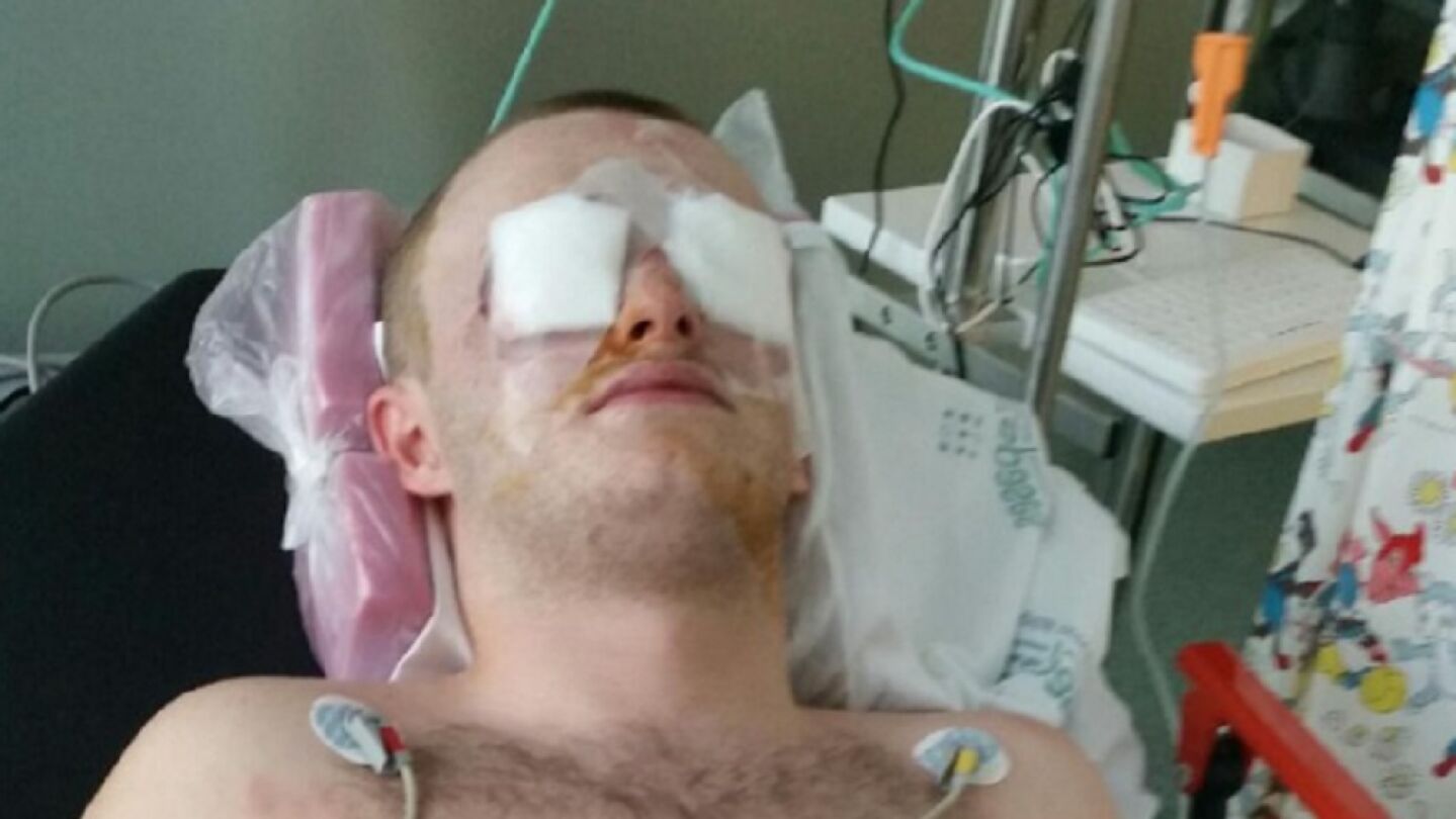 Imagen del joven escoc&eacute;s que recibi&oacute; un disparo en los ojos con una pistola de pintura en Magaluf