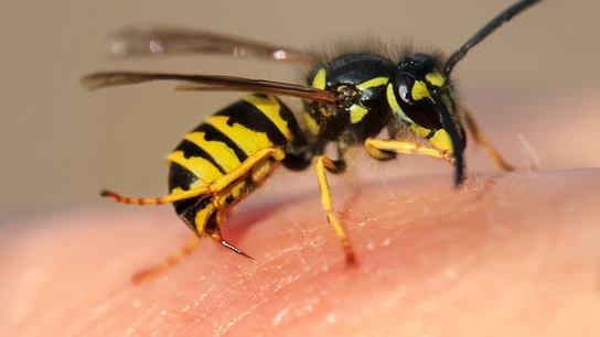 Picadura avispa Picadura avispa
