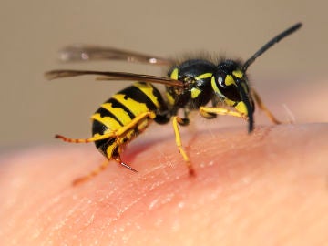 Picadura avispa Picadura avispa