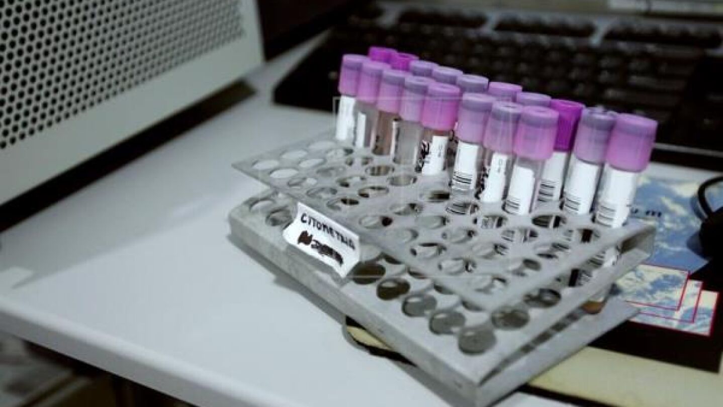 C&aacute;ncer de Colon