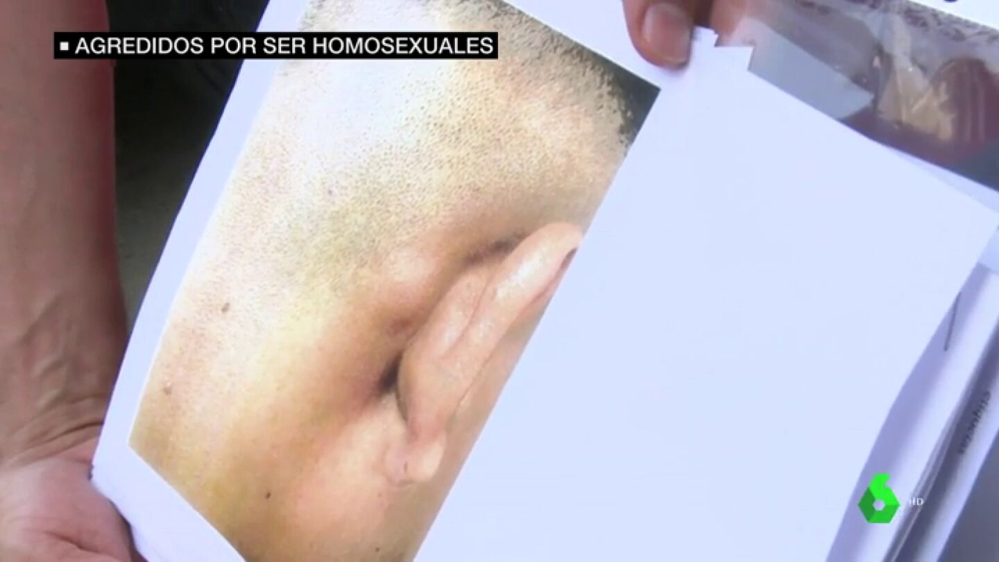 Nueva agresi&oacute;n hom&oacute;foba: hieren y amenazan de muerte a una pareja gay en Fuenlabrada cuando paseaban de la mano