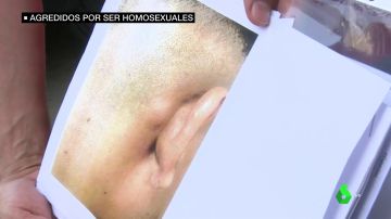 Nueva agresión homófoba: hieren y amenazan de muerte a una pareja gay en Fuenlabrada cuando paseaban de la mano