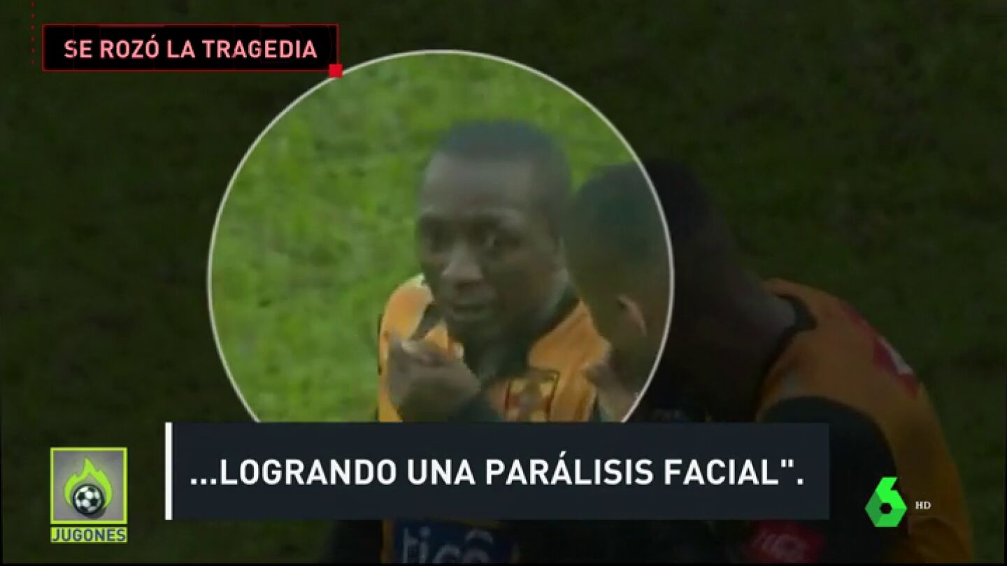 Parocardiaco_Bolvia