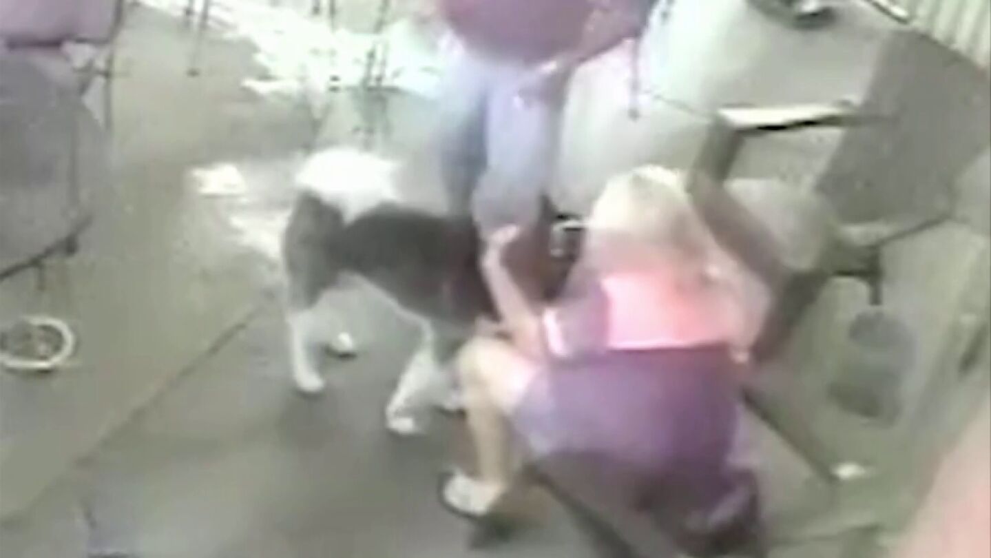 Una mujer se somete a una cirug&iacute;a facial despu&eacute;s de que un perro le mordiera la cara