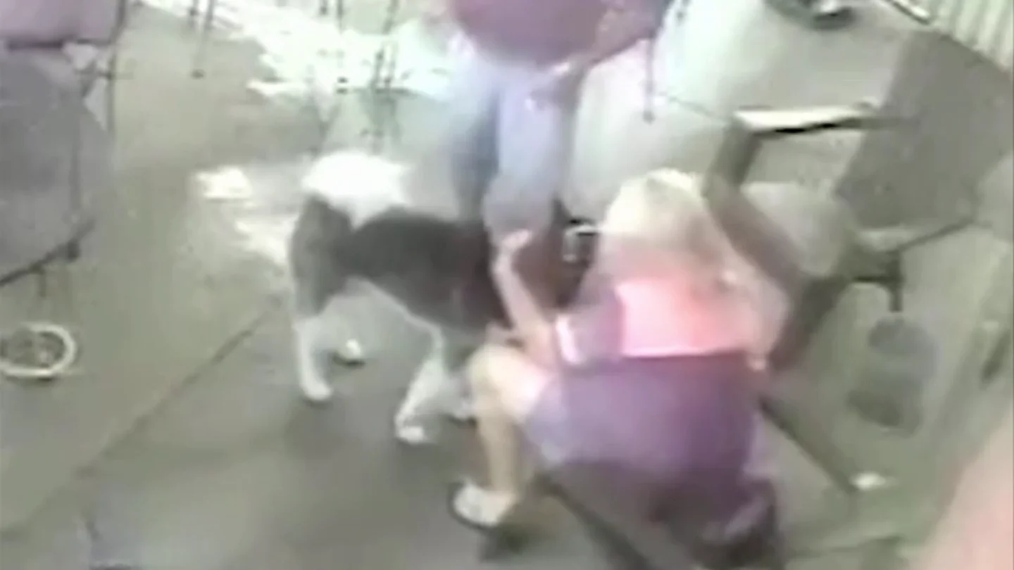 Una mujer se somete a una cirugía facial después de que un perro le mordiera la cara Una mujer se somete a una cirugía facial después de que un perro le mordiera la cara