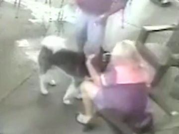 Una mujer se somete a una cirugía facial después de que un perro le mordiera la cara Una mujer se somete a una cirugía facial después de que un perro le mordiera la cara