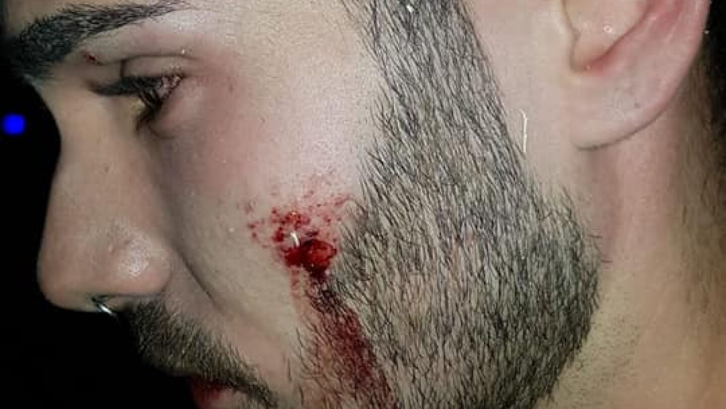 Agredido en la discoteca de Alcorc&oacute;n 