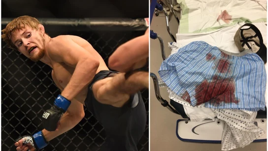 El accidente que horroriza a la UFC El accidente que horroriza a la UFC