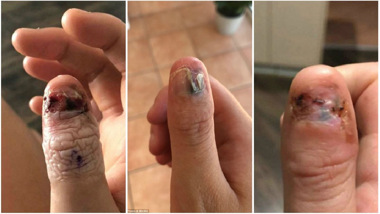 Im&aacute;genes del pulgar de Courtney Whithorn