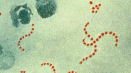 Imagen de archivo de la bacteria 'Streptococcus Pyogenes'