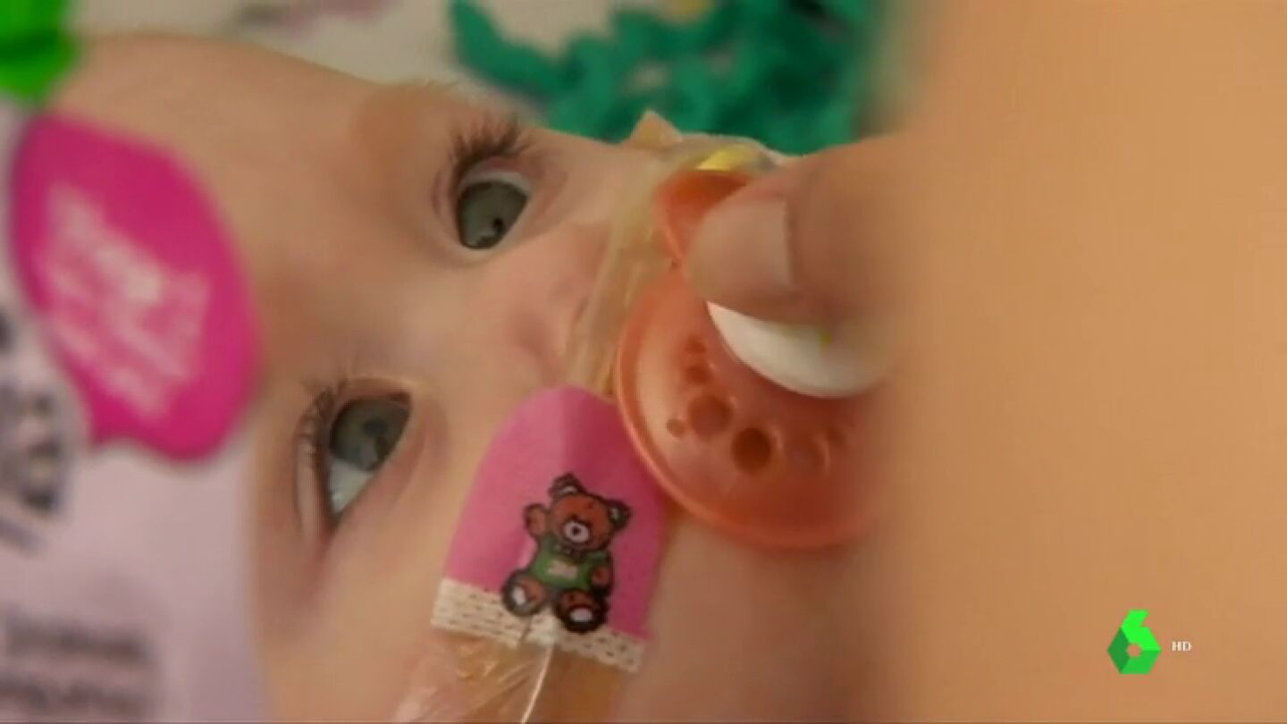 Vanellope Hope Wilkins, la ni&ntilde;a que naci&oacute; con el coraz&oacute;n fuera del pecho