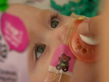 Vanellope Hope Wilkins, la niña que nació con el corazón fuera del pecho Vanellope Hope Wilkins, la niña que nació con el corazón fuera del pecho