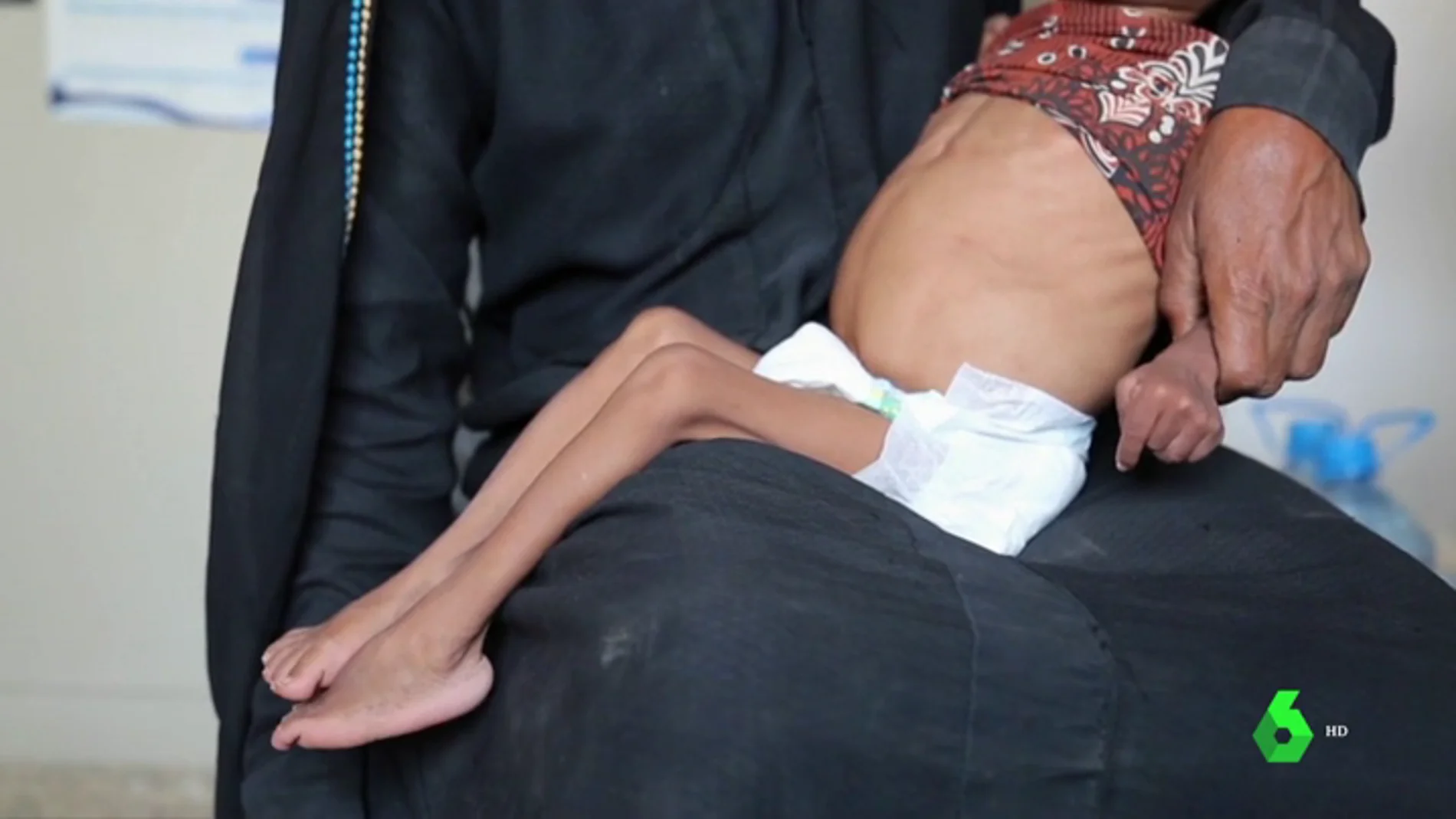 El hambre amenaza a más de cinco millones de niños en Yemen