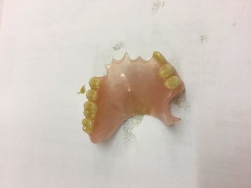Dentadura postiza Dentadura postiza