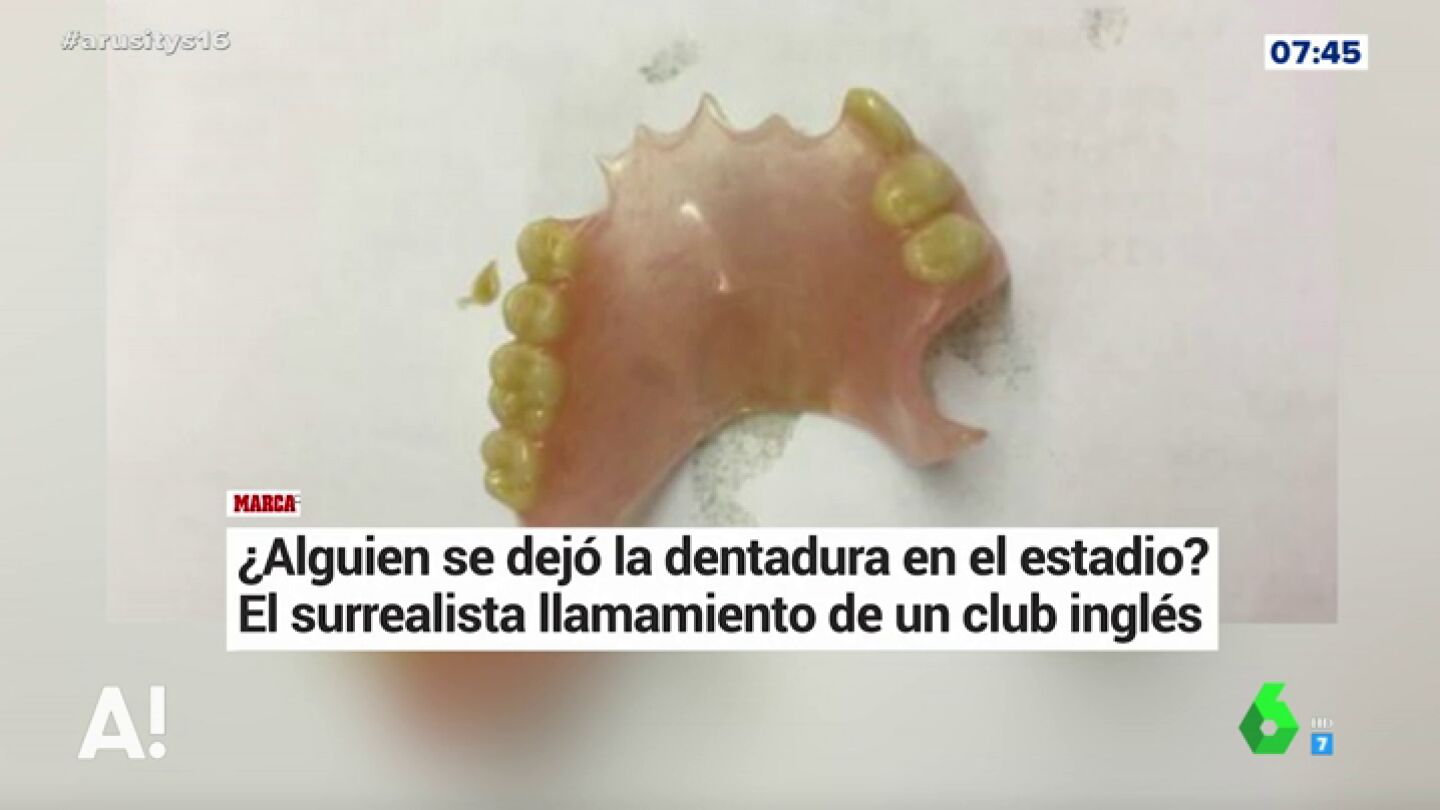 &iquest;Qui&eacute;n se habr&aacute; dejado la dentadura?