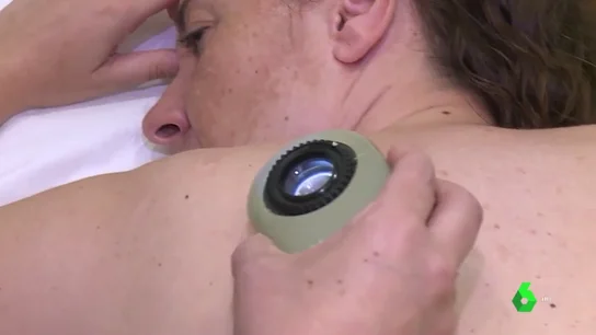 Una paciente sometiéndose a un tratamiento de inmunoterapia Una paciente sometiéndose a un tratamiento de inmunoterapia
