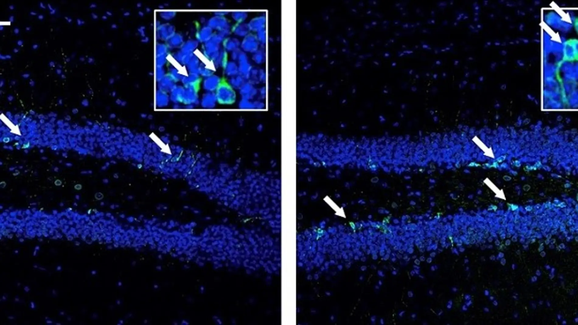 Imagen de microscopía del hipocampo