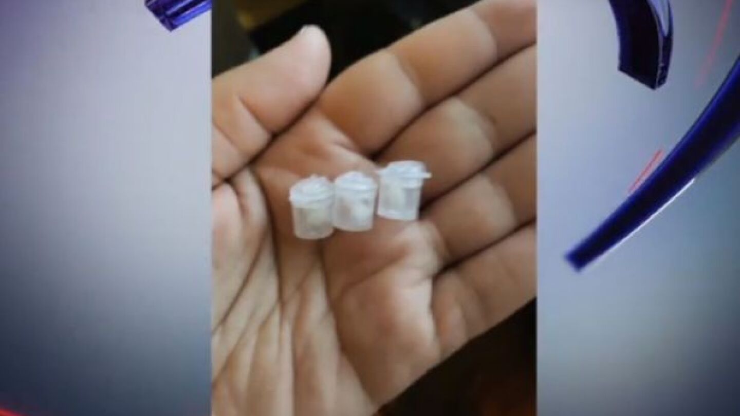 C&aacute;psulas de droga encontradas en manos de la ni&ntilde;a