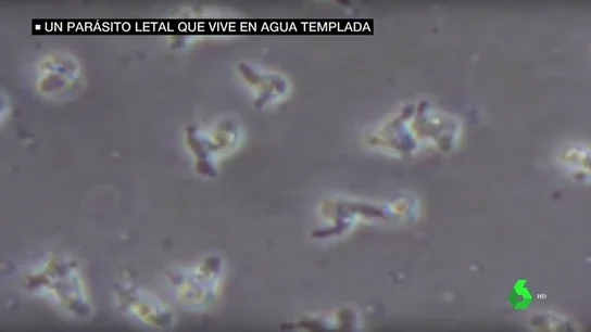 Una niña afectada por la ameba 'comecerebros' sobrevive gracias a una combinación experimental de fármarcos Una niña afectada por la ameba 'comecerebros' sobrevive gracias a una combinación experimental de fármarcos