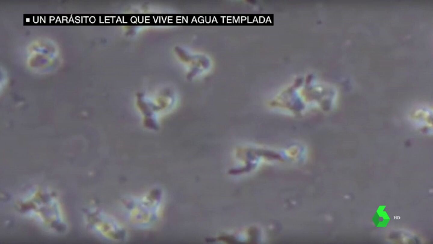 Una ni&ntilde;a afectada por la ameba 'comecerebros' sobrevive gracias a una combinaci&oacute;n experimental de f&aacute;rmarcos