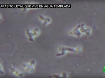 Una niña afectada por la ameba 'comecerebros' sobrevive gracias a una combinación experimental de fármarcos Una niña afectada por la ameba 'comecerebros' sobrevive gracias a una combinación experimental de fármarcos