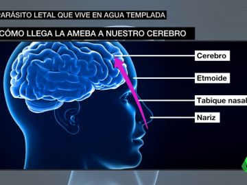 Cuidado con la ameba 'comecerebros': te explicamos de dónde sale y sus peligrosos efectos Cuidado con la ameba 'comecerebros': te explicamos de dónde sale y sus peligrosos efectos