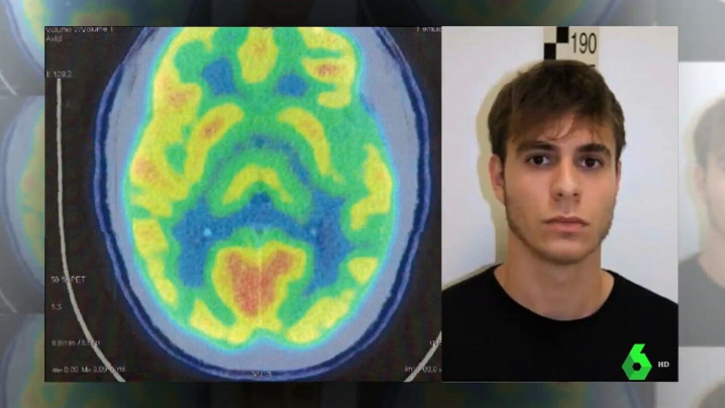 El informe psiqui&aacute;trico del cerebro de Patrick Nogueira