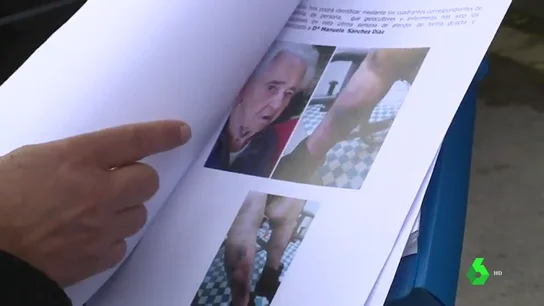 Denuncian la pésimas condiciones en una residencia de Leganés: "Es la cuarta vez que apreciamos golpes" Denuncian la pésimas condiciones en una residencia de Leganés: "Es la cuarta vez que apreciamos golpes"