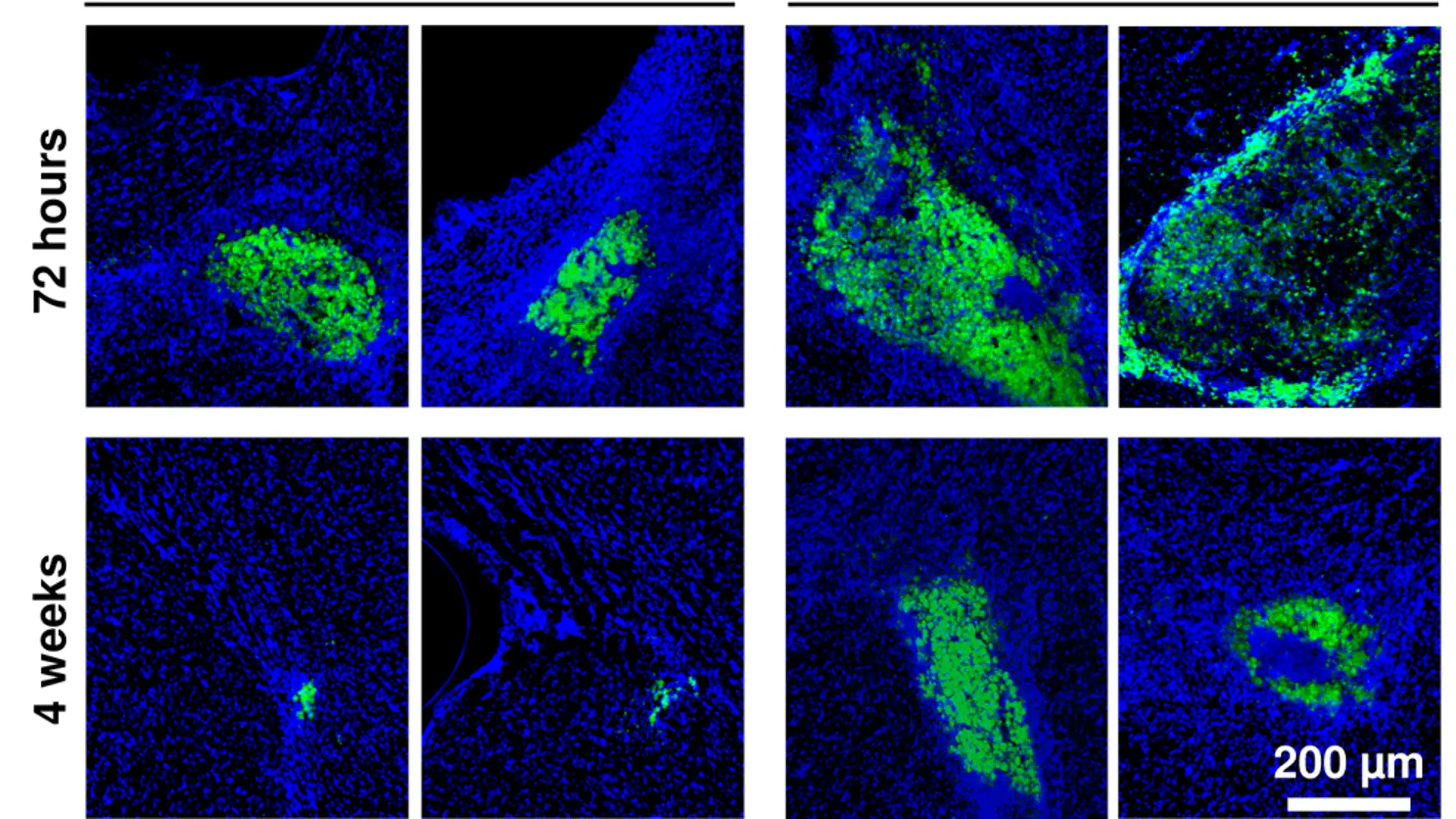 Imágenes de microscopia de fluorescencia mostrando células madre injertadas en el tejido cerebral