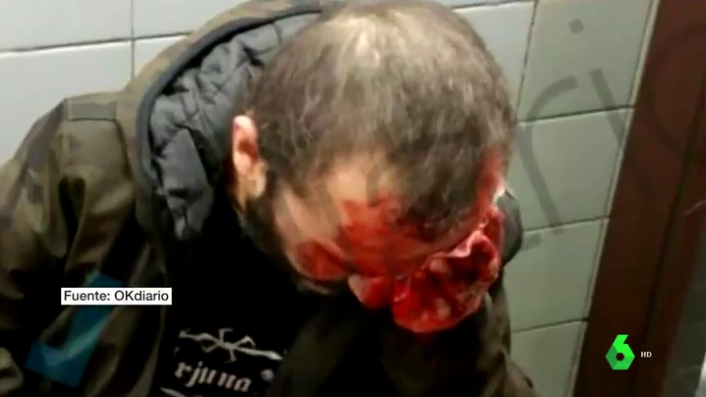 Herido un hombre que llevaba una bandera de Espa&ntilde;a al ser empujado por las escaleras del metro de Barcelona