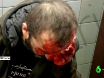 Herido un hombre que llevaba una bandera de España al ser empujado por las escaleras del metro de Barcelona Herido un hombre que llevaba una bandera de España al ser empujado por las escaleras del metro de Barcelona