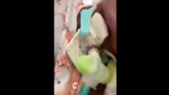 Imagen de la paciente repleta de hormigas en su cama de hospital Imagen de la paciente repleta de hormigas en su cama de hospital