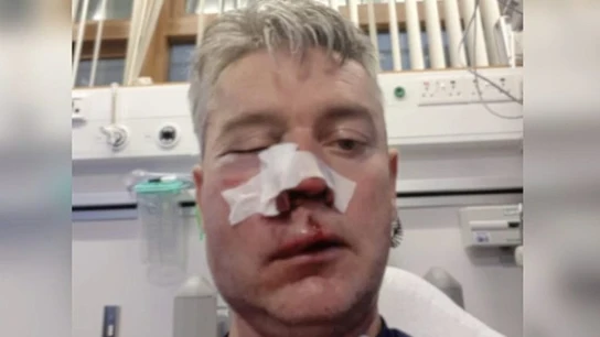 Daniel Sweeney, en el hospital tras la agresión Daniel Sweeney, en el hospital tras la agresión