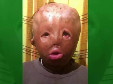 La desgarradora carta a Papa Noel de un niño con la cara completamente quemada: "Sólo quiero ser como los demás" La desgarradora carta a Papa Noel de un niño con la cara completamente quemada: "Sólo quiero ser como los demás"