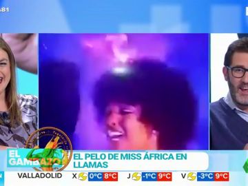 El pelo de Miss África ardiendo El pelo de Miss África ardiendo