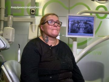 Una paciente que se sometió al tratamiento estrella de iDental Una paciente que se sometió al tratamiento estrella de iDental