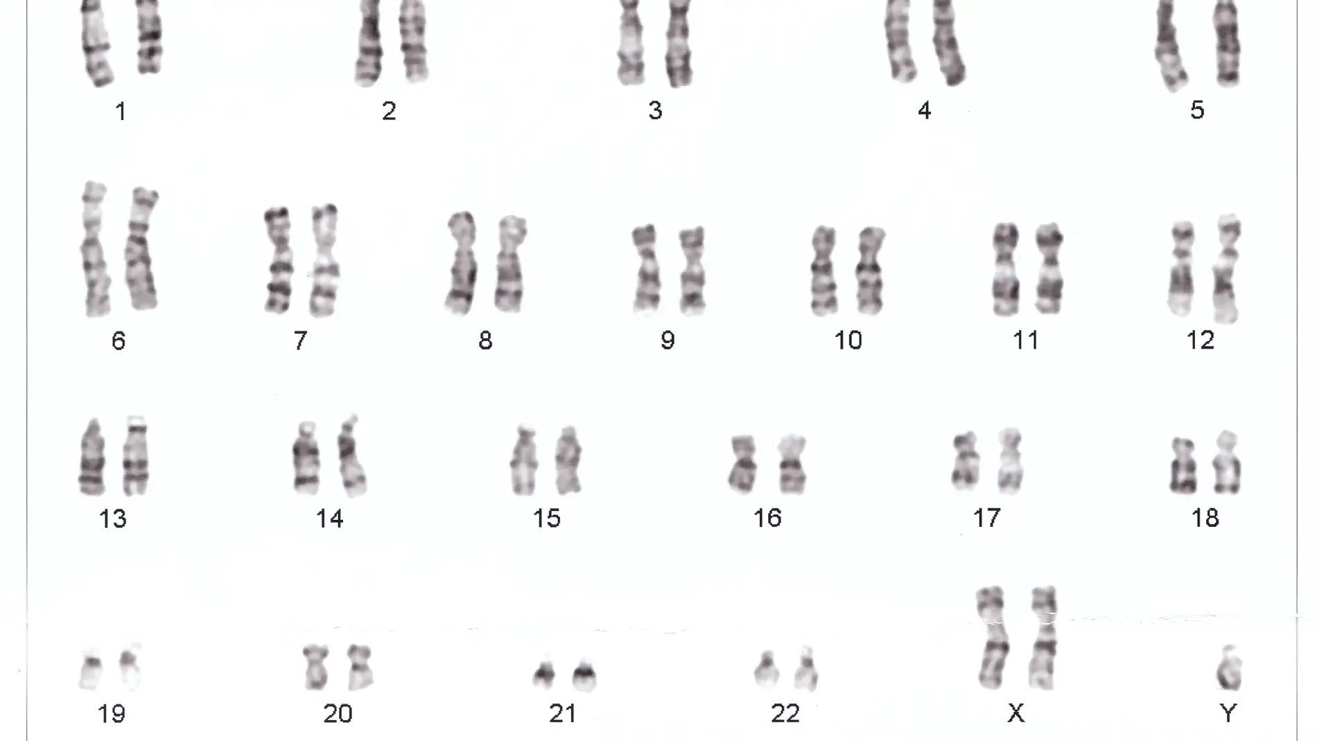 imagen de cromosomas humanos