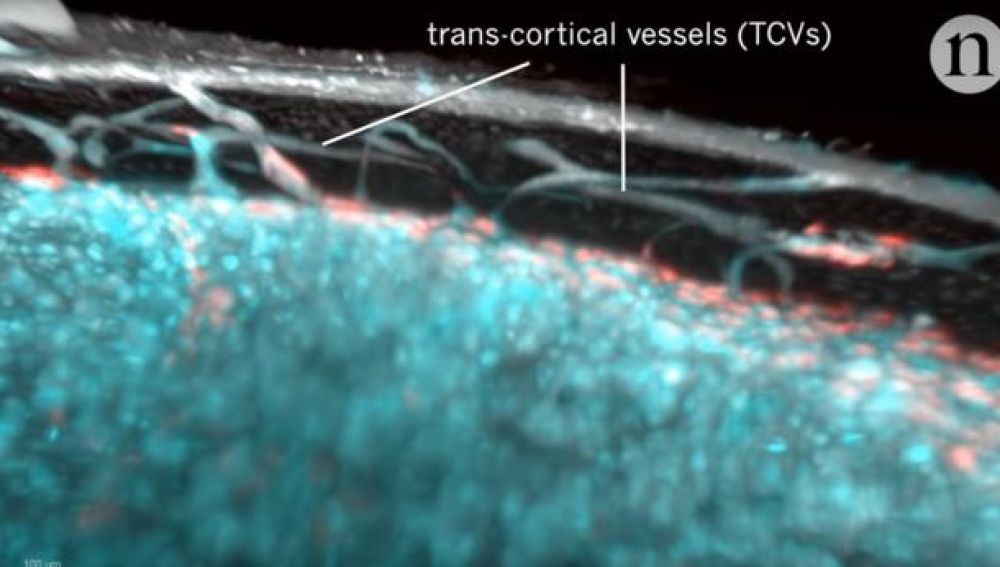 Los vasos transcorticales que se han descubierto en los huesos.
