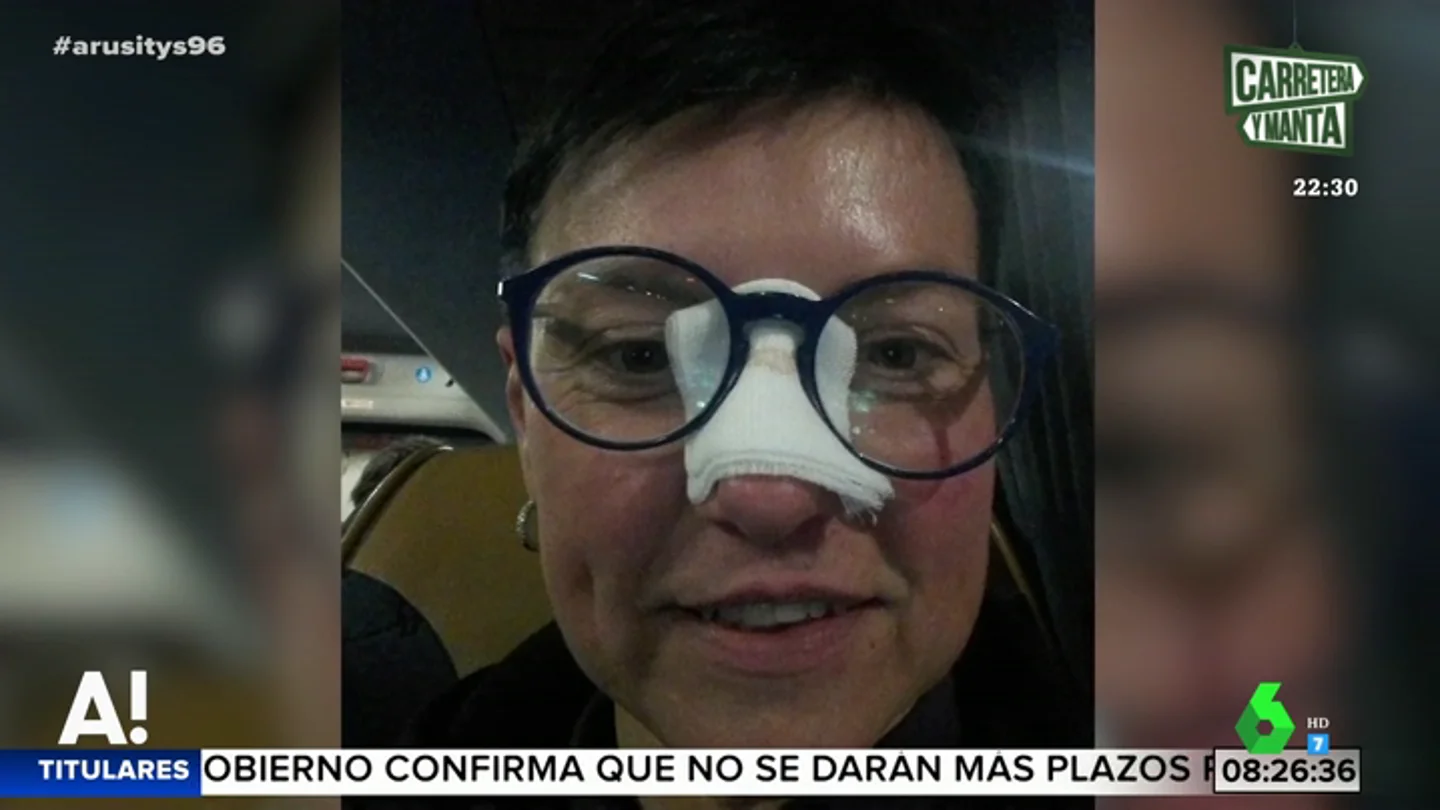 La reacción de una aficionada tras recibir un balonazo de Cristiano Ronaldo: "Gracias a todos por el apoyo" La reacción de una aficionada tras recibir un balonazo de Cristiano Ronaldo: "Gracias a todos por el apoyo"