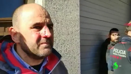 Imagen de un militante de Ciudadanos supuestamente agredido por independentistas Imagen de un militante de Ciudadanos supuestamente agredido por independentistas