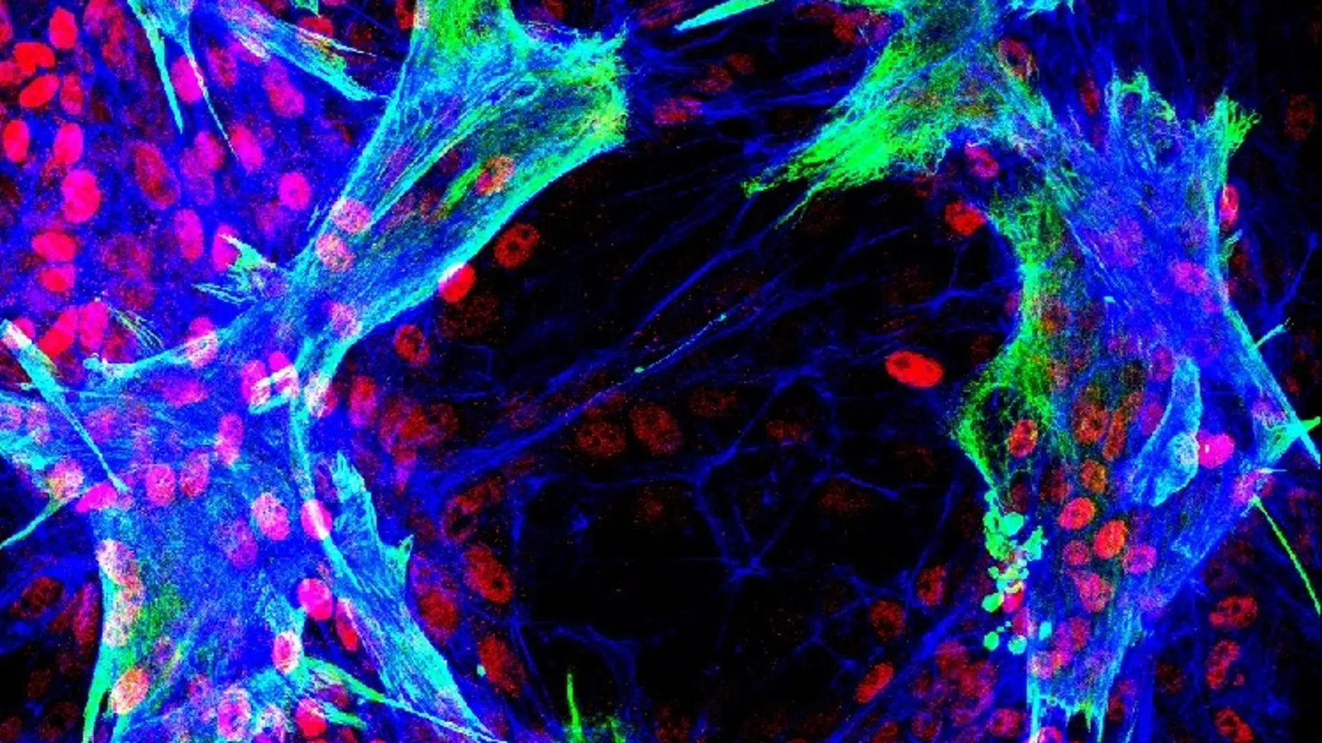 células estrelladas hepáticas primarias humanas
