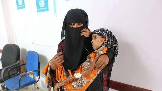 Fatima Qoba en una clínica de desnutrición Fatima Qoba en una clínica de desnutrición