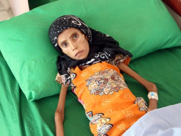 Fatima, con 12 años, sólo pesa 10 kilos Fatima, con 12 años, sólo pesa 10 kilos