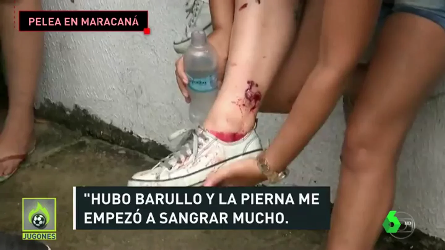 Serios incidentes en los aledaños de Maracaná: balas de goma, gas pimienta, batalla campal... Serios incidentes en los aledaños de Maracaná: balas de goma, gas pimienta, batalla campal...