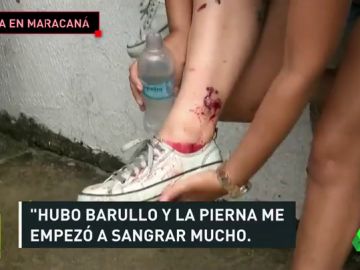 Serios incidentes en los aledaños de Maracaná: balas de goma, gas pimienta, batalla campal... Serios incidentes en los aledaños de Maracaná: balas de goma, gas pimienta, batalla campal...